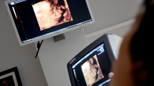 ultrazvok trebuha