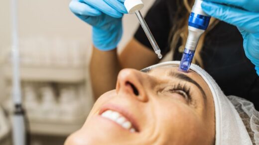 Microneedling